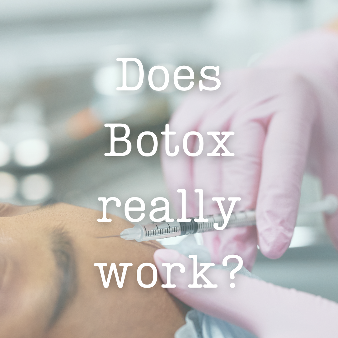 Does Botox actually work?