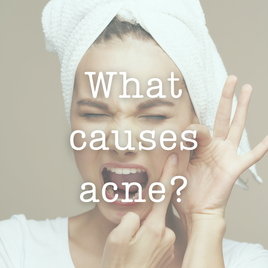 What Causes Acne?